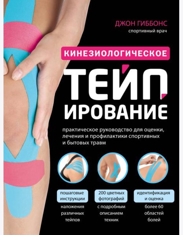 Кинезиологическое тейпирование