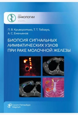 Биопсия сигнальных лимфатических узлов при раке молочной железы