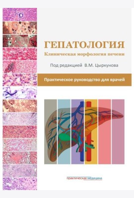 Гепатология. Клиническая морфология печени. Практическое руководство для врачей