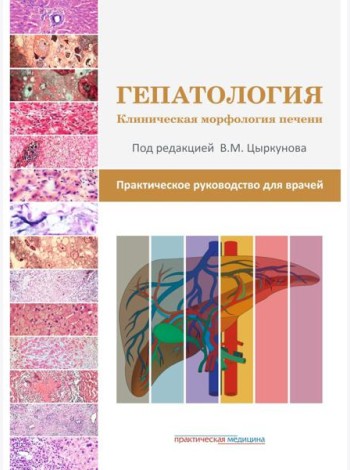 Гепатология. Клиническая морфология печени. Практическое руководство для врачей