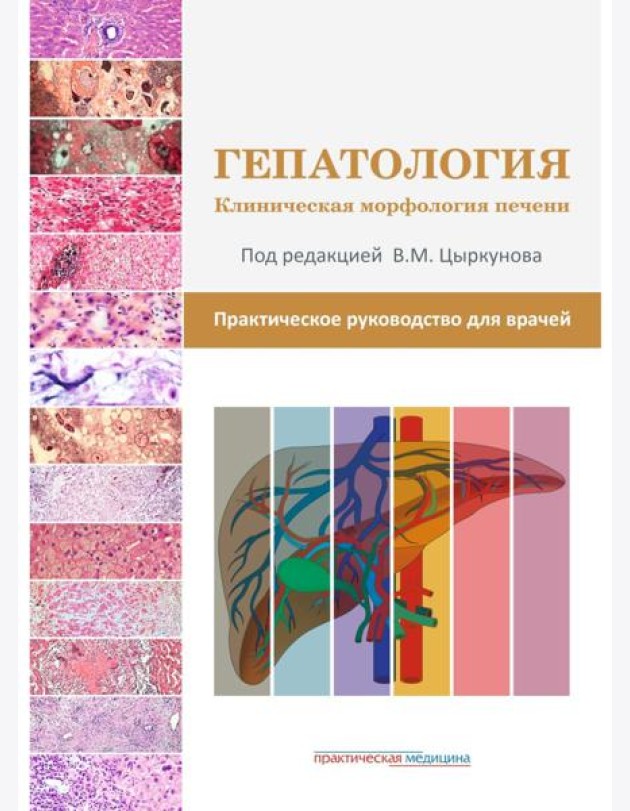 Гепатология. Клиническая морфология печени. Практическое руководство для врачей