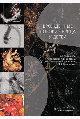 Врожденные пороки сердца у детей: руководство для врачей
