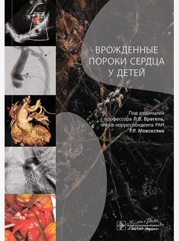 Врожденные пороки сердца у детей: руководство для врачей