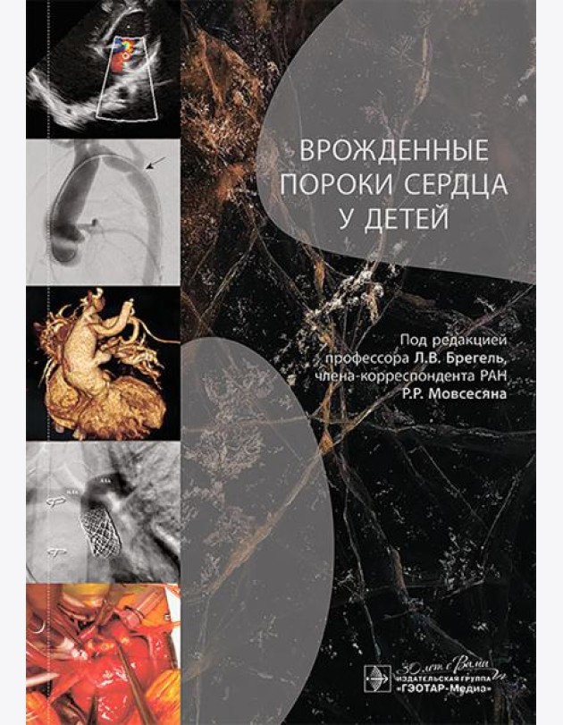 Врожденные пороки сердца у детей: руководство для врачей