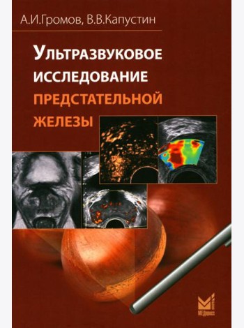 Ультразвуковое исследование предстательной железы