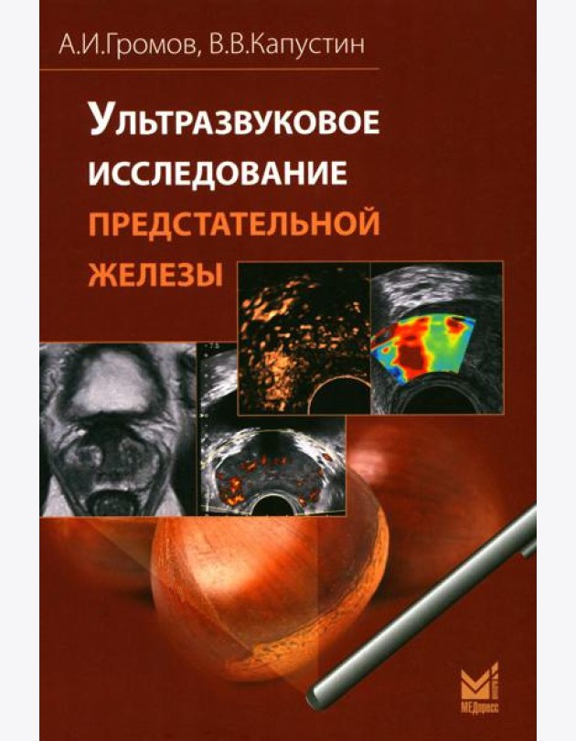 Ультразвуковое исследование предстательной железы