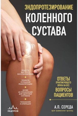 Эндопротезирование коленного сустава: ответы практикующего врача на все вопросы пациентов