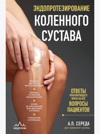 Эндопротезирование коленного сустава: ответы практикующего врача на все вопросы пациентов