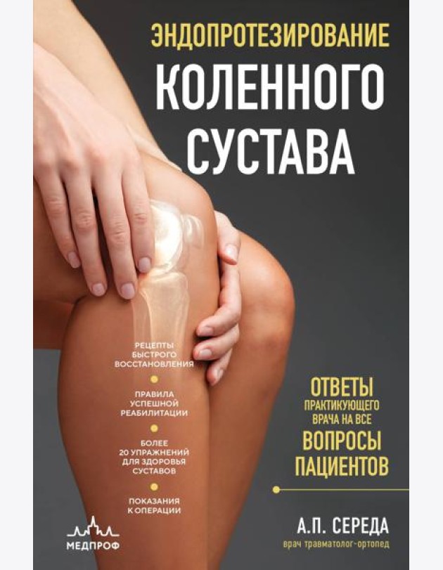Эндопротезирование коленного сустава: ответы практикующего врача на все вопросы пациентов