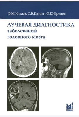 Лучевая диагностика заболеваний головного мозга