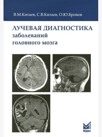 Лучевая диагностика заболеваний головного мозга