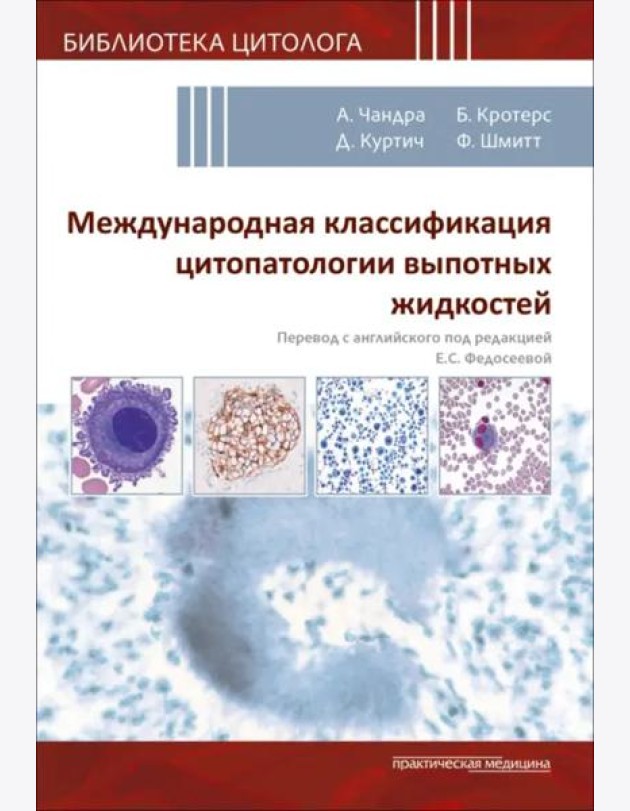 Международная классификация цитопатологии выпотных жидкостей
