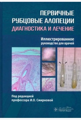 Первичные рубцовые алопеции. Диагностика и лечение. Иллюстрированное руководство для врачей