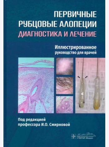 Первичные рубцовые алопеции. Диагностика и лечение. Иллюстрированное руководство для врачей