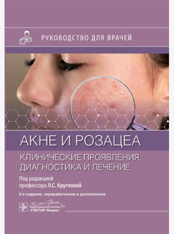 Акне и розацеа. Клинические проявления, диагностика и лечение: руководство для врачей. 2-е изд., перераб. и доп