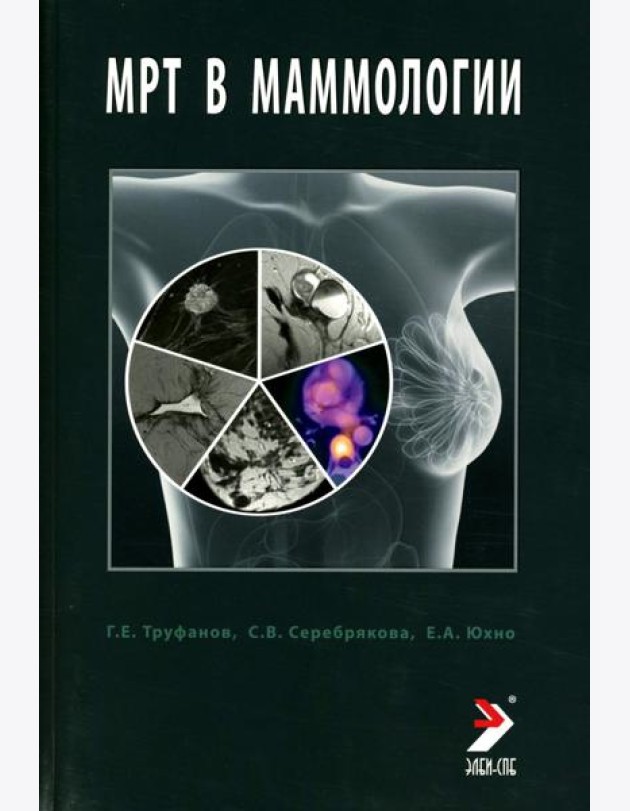МРТ в маммологии: руководство для врачей