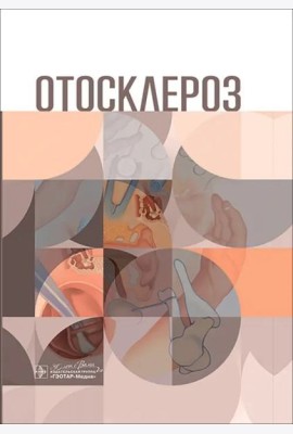 Отосклероз