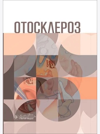 Отосклероз