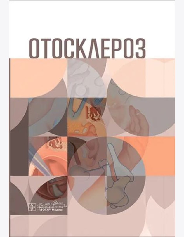 Отосклероз