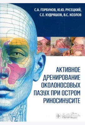 Активное дренирование околоносовых пазух при остром риносинусите