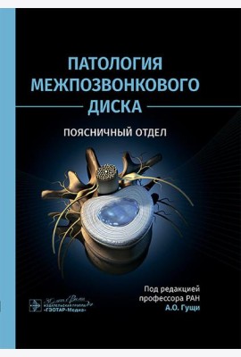 Патология межпозвонкового диска. Поясничный отдел