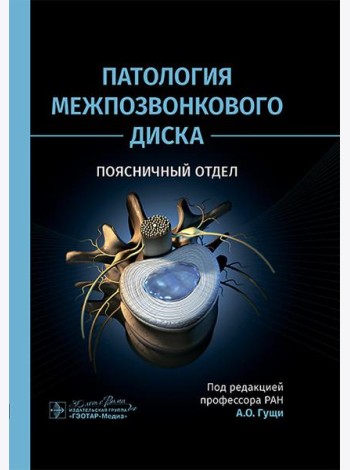 Патология межпозвонкового диска. Поясничный отдел