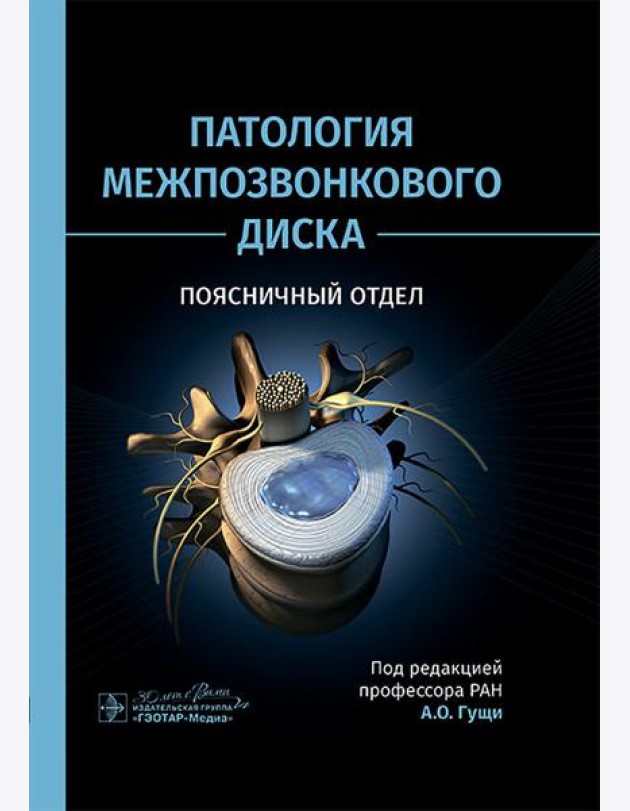 Патология межпозвонкового диска. Поясничный отдел