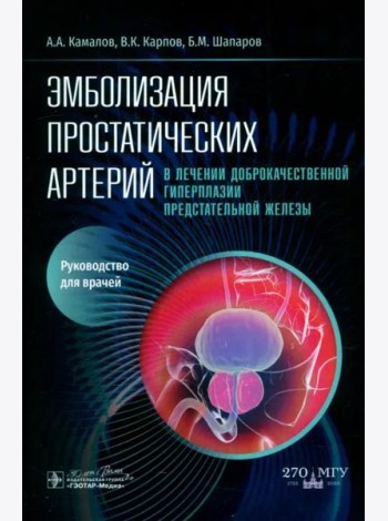 Эмболизация простатических артерий в лечении доброкачественной гиперплазии предстательной железы