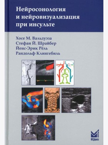 Нейросонология и нейровизуализация при инсульте. 3-е изд