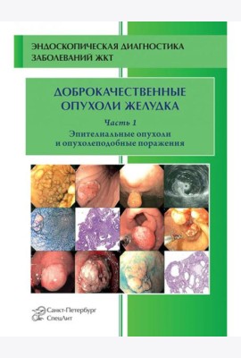 Доброкачественные опухоли желудка. Ч. 1: Эпителиальные опухоли и опухолеподобные поражения: Учебно-методическое пособие. 2-е изд., испр. и доп