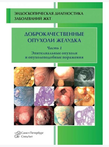 Доброкачественные опухоли желудка. Ч. 1: Эпителиальные опухоли и опухолеподобные поражения: Учебно-методическое пособие. 2-е изд., испр. и доп