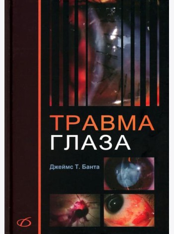 Травма глаза
