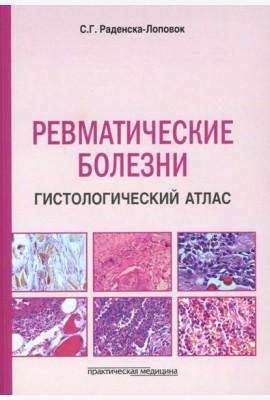 Ревматические болезни. Гистологический атлас