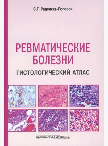 Ревматические болезни. Гистологический атлас