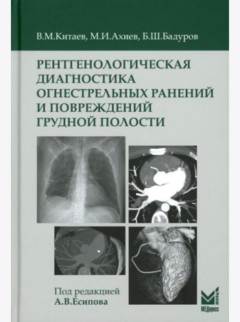 Рентгенологическая диагностика огнестрельных ранений и повреждений грудной полости