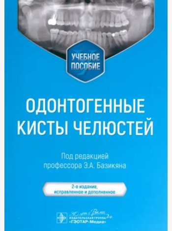 Одонтогенные кисты челюстей