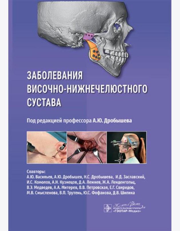 Заболевания височно-нижнечелюстного сустава