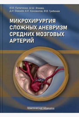 Микрохирургия сложных аневризм средних мозговых артерий: гигантских, фузиформных и частично тромбированных