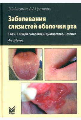 Заболевания слизистой оболочки рта. Связь с общей патологией. Диагностика. Лечение