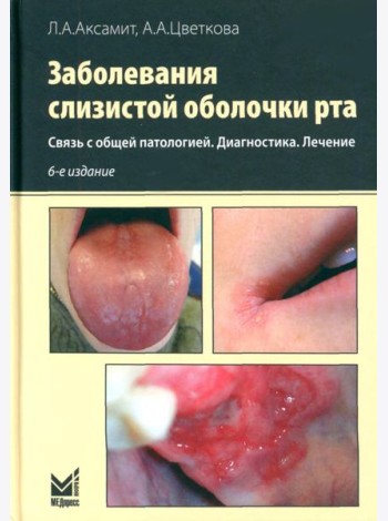 Заболевания слизистой оболочки рта. Связь с общей патологией. Диагностика. Лечение
