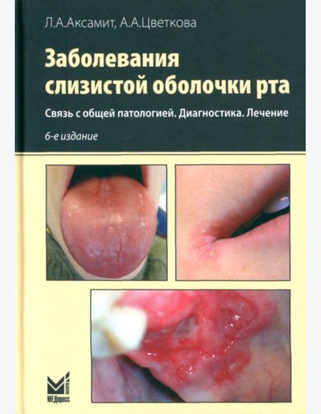 Заболевания слизистой оболочки рта. Связь с общей патологией. Диагностика. Лечение
