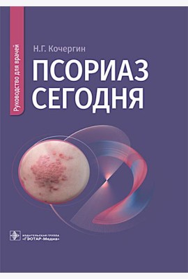 Псориаз сегодня: руководство для врачей