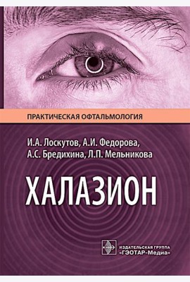 Халазион