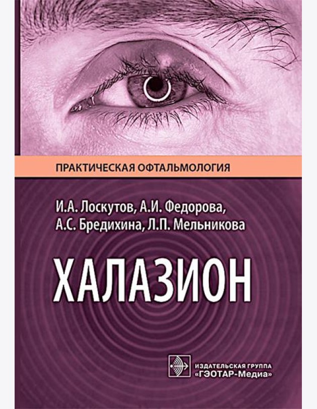 Халазион