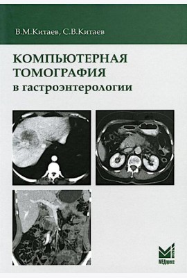 Компьютерная томография в гастроэнтерологии: руководство для врачей. 3-е изд., испр.и доп