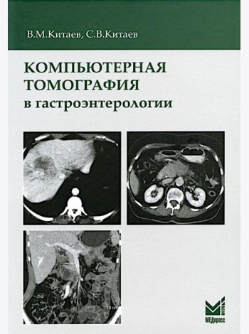 Компьютерная томография в гастроэнтерологии: руководство для врачей. 3-е изд., испр.и доп