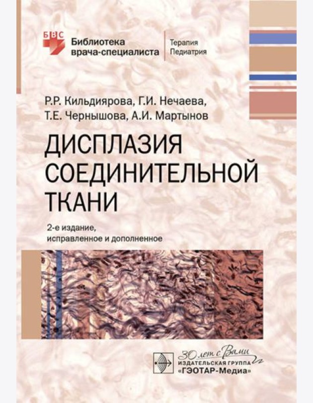 Дисплазия соединительной ткани. 2-е изд., испр. и доп