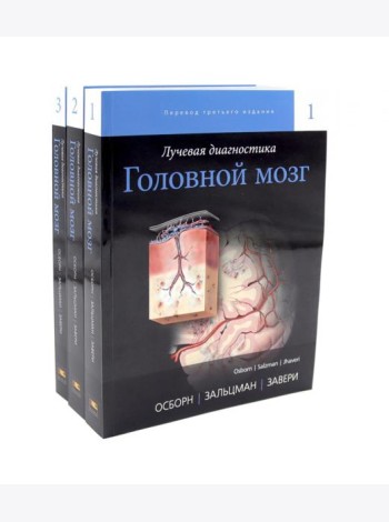 Лучевая диагностика. Головной мозг. В 3 т