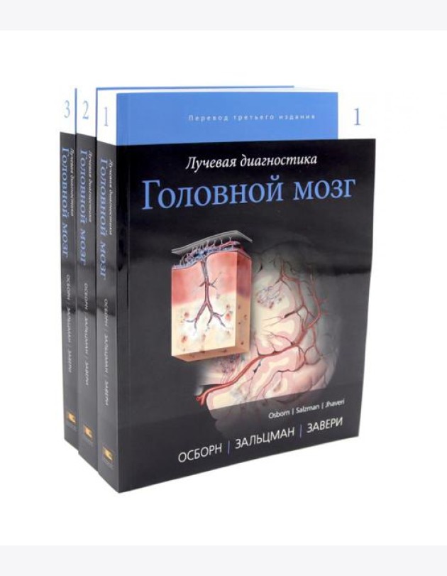 Лучевая диагностика. Головной мозг. В 3 т
