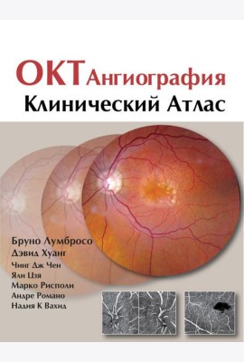 ОКТ-ангиография. Клинический атлас